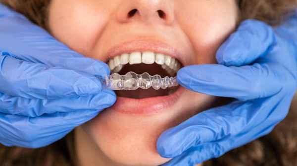 orthodontist Lancaster