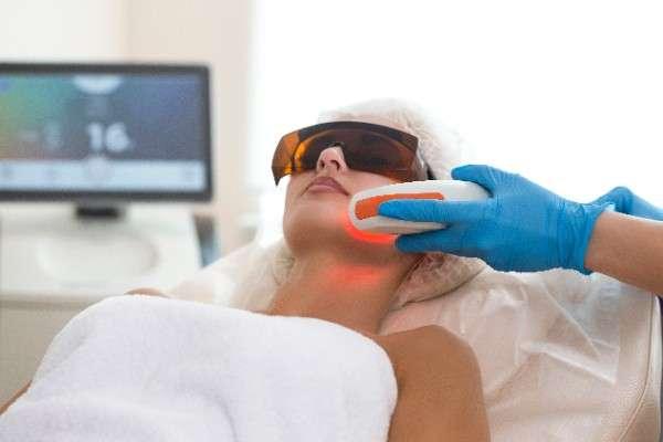 laser hair removal in Edinburgh 